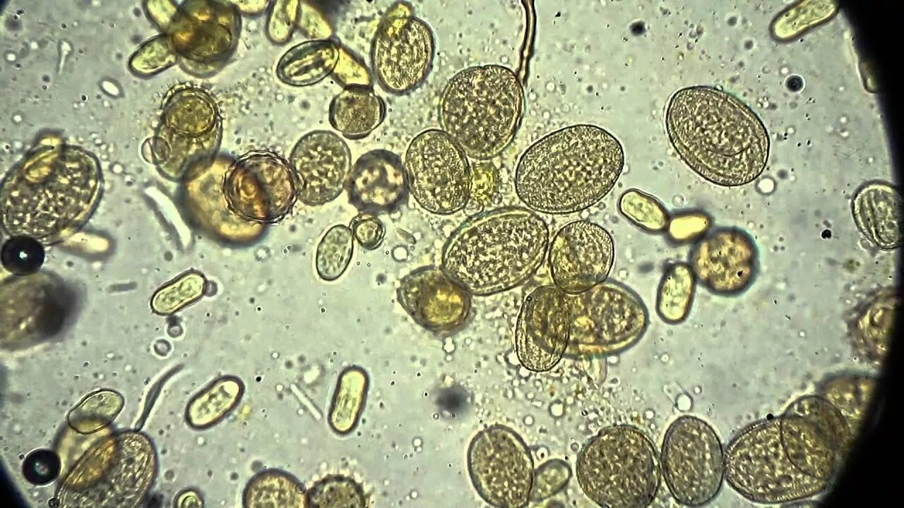 Мед под микроскопом фото Pieces of Honeybee Pollen Load under the Microscope, Magnification X400.Case 6. 