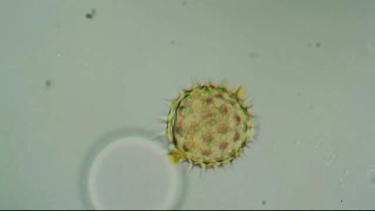 Мед в микроскопе фото What's this in honey? Что это в меде? Мед под микроскопом. Honey under microscop