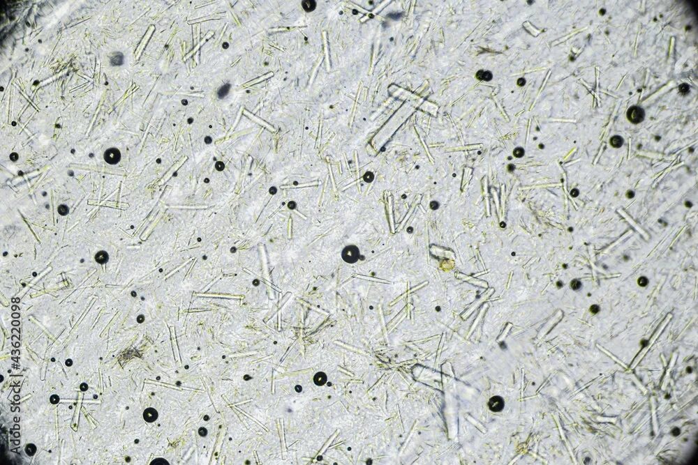 Мед в микроскопе фото Artificial honey with large rectangular sugar crystals under microscope. Natural