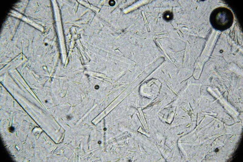 Мед в микроскопе фото Artificial Honey with Large Rectangular Sugar Crystals Under Microscope. Natural