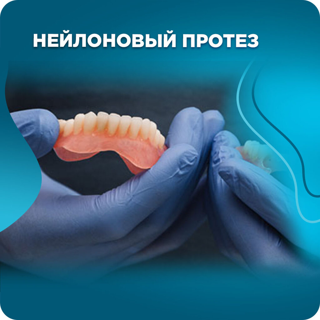 Медиа лэнд промышленная ул 49 ульяновск фото Виниры - Семейная стоматология "Медиа-Лэнд" - Стоматологическая клиник