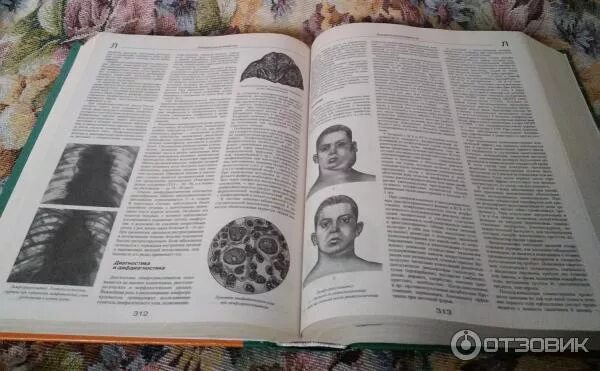 Медицинская энциклопедия фото Отзыв о Серия книг "Большая медицинская энциклопедия" - издательство Эксмо Полез