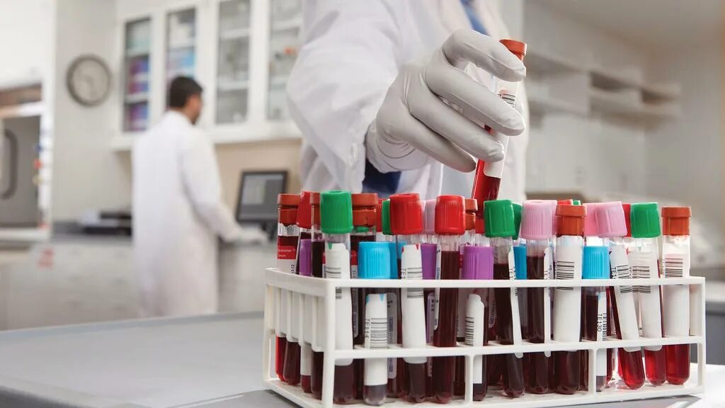 Медицинская лаборатория фото Considerations for Infectious Disease Testing in YOUR Laboratory - Siemens Healt