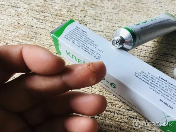 Медицинский клей бф фото Отзыв о Клей медицинский Тульская фармацевтическая фабрика "БФ-6" Подождал 15 ми