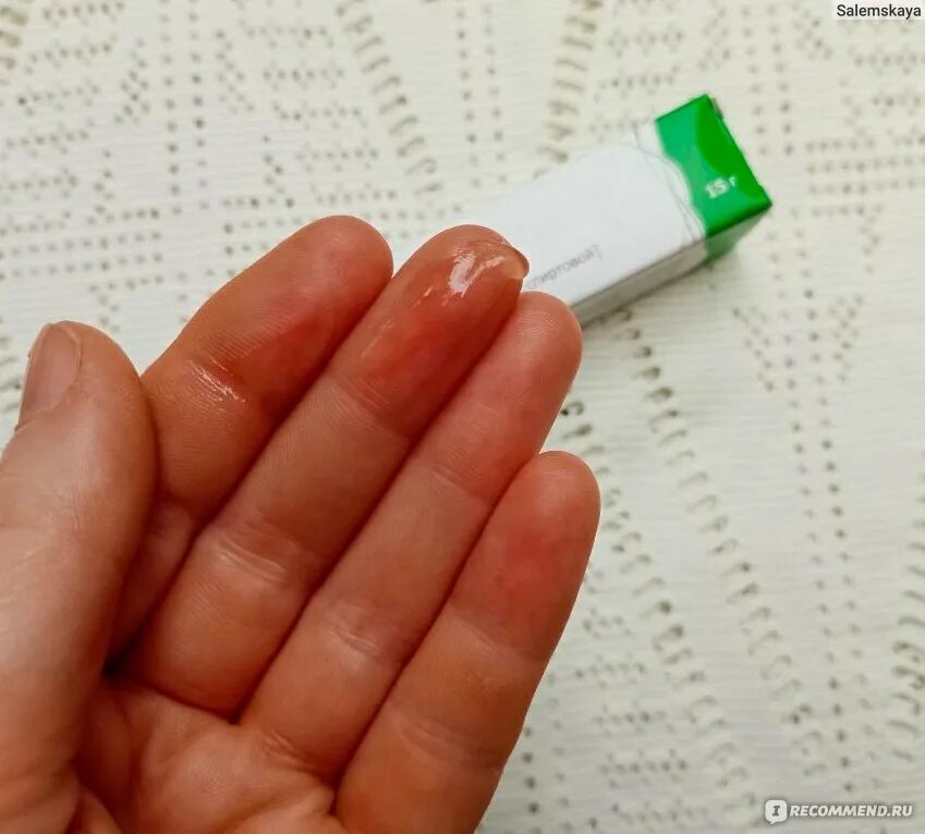Медицинский клей фото Медицинский клей Тульская фармацевтическая фабрика БФ-6 - "Медицинский клей БФ-6