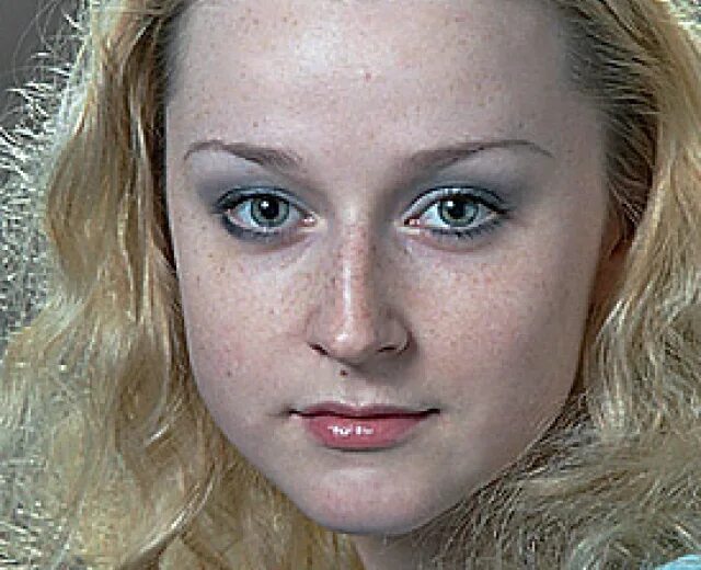 Медынич ольга фото до пластики Медынич операции и после фото: найдено 90 изображений