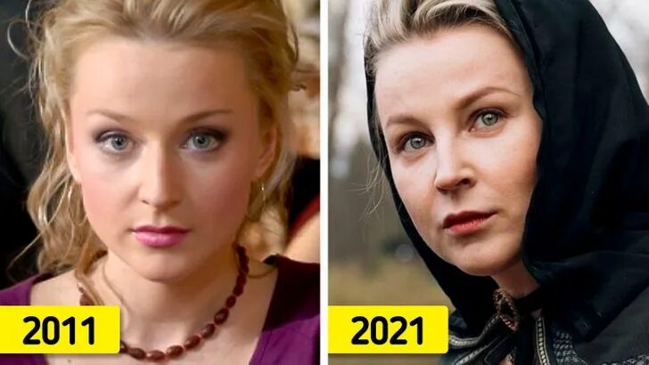 Медынич ольга фото до пластики Как изменились актеры и актрисы российских сериалов, от просмотра которых мы ког