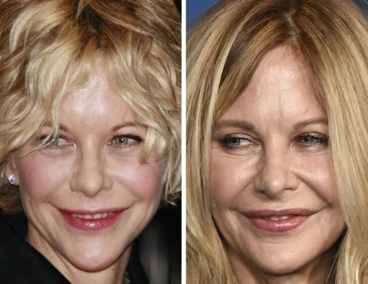 Мег райан фото до и после пластики 20+ Photos That Clearly Show How Celebrities Have Changed in the Past 10 Years /