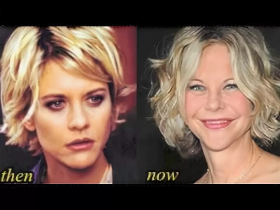 Мег райан фото до и после пластики Meg Ryan Before and After Plastic Surgery Photos - YouTube
