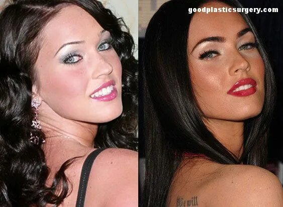 Меган фокс до пластики и после фото Megan Fox Before and After Rhinoplasty Inspirational celebrities, Plastic surger