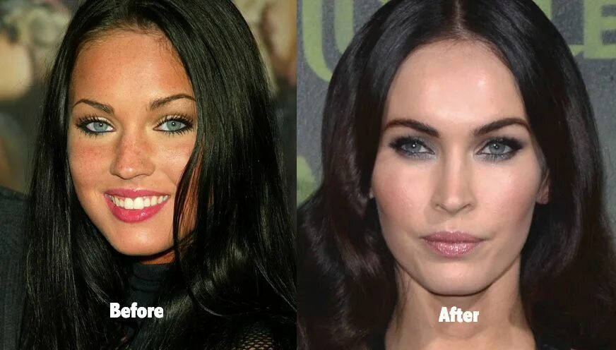 Меган фокс фото до и после Extraordinary & extreme plastic surgery before and after photo session