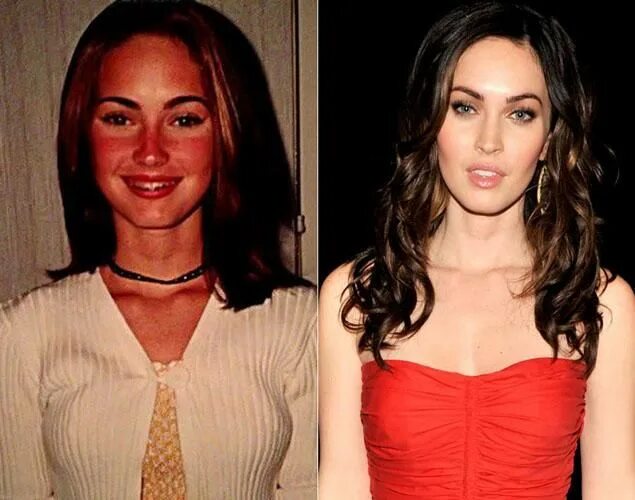 Меган фокс фото до и после Megan Fox, antes y despues Celebrities with braces, Hollywood, Hollywood stars