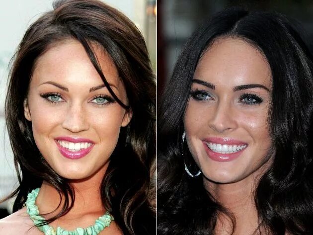 Меган фокс фото до и после Megan Fox Veneers Before And After Зубы, Голливуд, Невеста