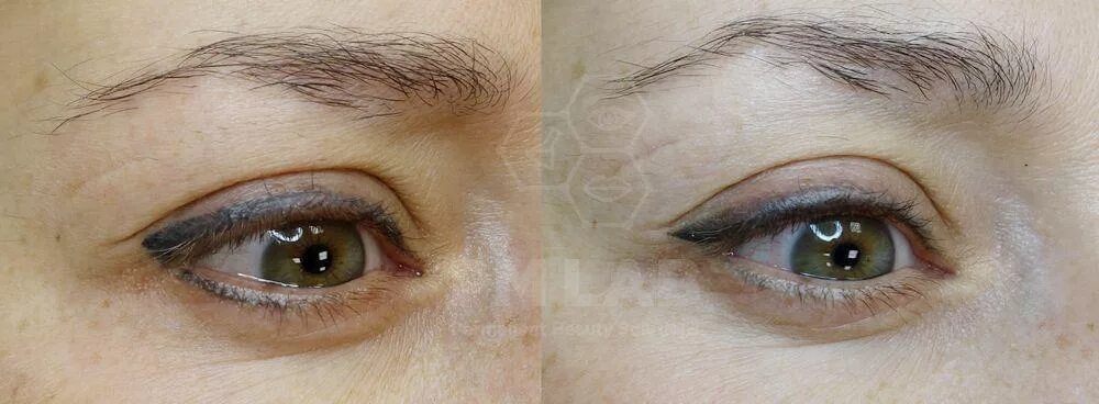 Минусы перманентного макияжа глаз Permanent make up for lower eyelids PM LABORATORY micropigmentation