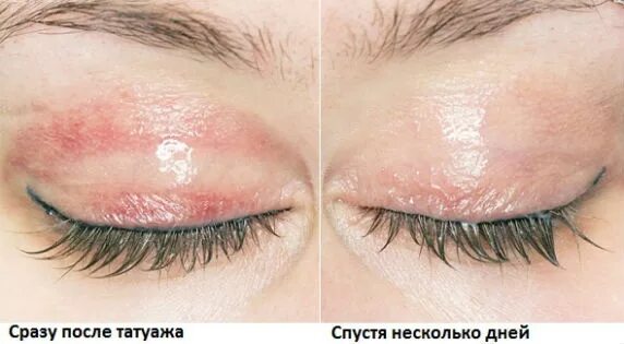 Минусы перманентного макияжа стрелок Перманентный макияж межресничного пространства больно ли - Красота