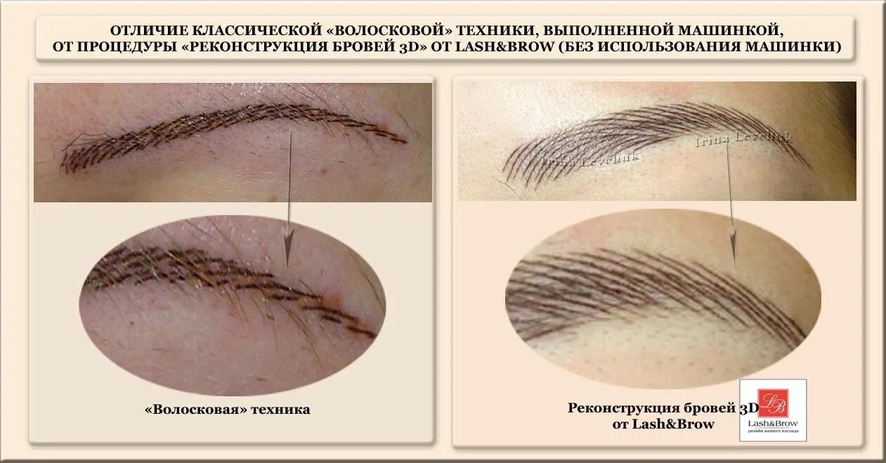 Минусы татуажа Чем отличается микроблейдинг от обычного и волоскового татуажа бровей?