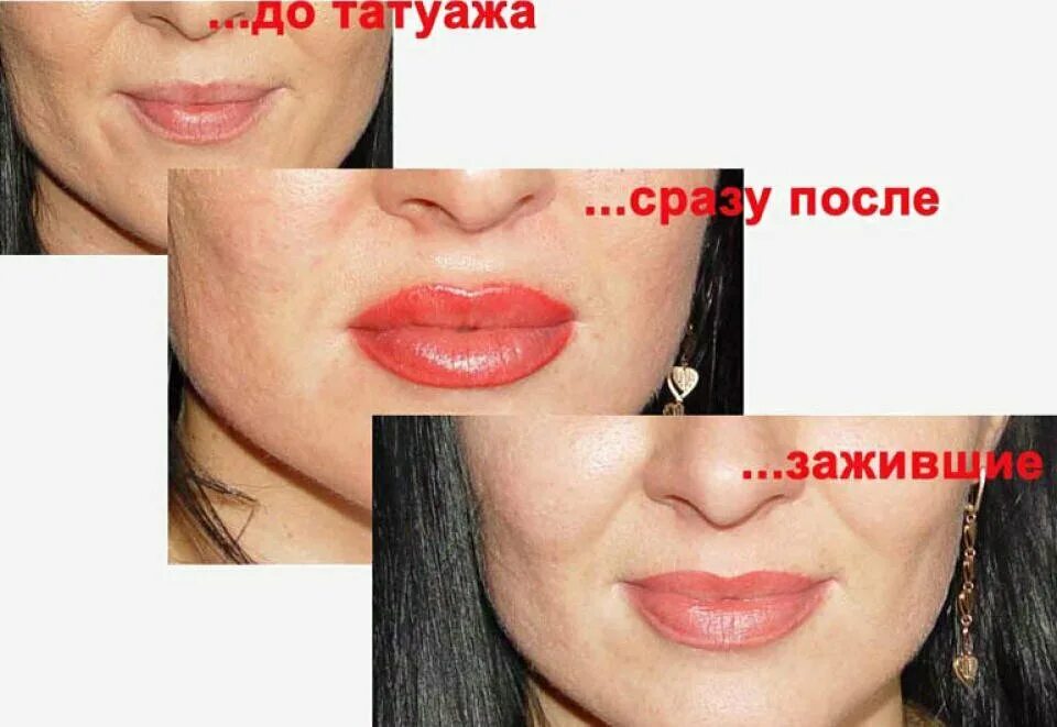 Минусы татуажа губ Антонина Ковтун - Красота, Процедуры для волос, Брови, Химки на Яндекс Услуги