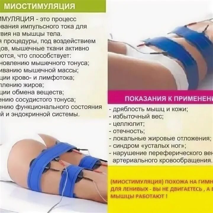 Миостимуляции отзывы фото до и после Екатерина Нечаева 2024 ВКонтакте