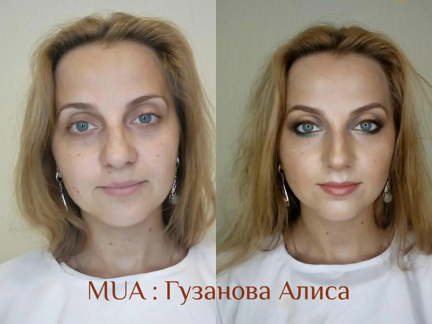 Миостимуляция лица отзывы фото до и после Фотографии Центр здоровья и красоты Золотой Век - Самара, Киевская, 15Б, 1 этаж 