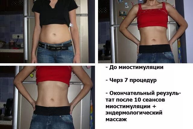 Миостимуляция тела отзывы фото до и после Миостимуляция тела отзывы до и после фото - ViktoriaFoto.ru