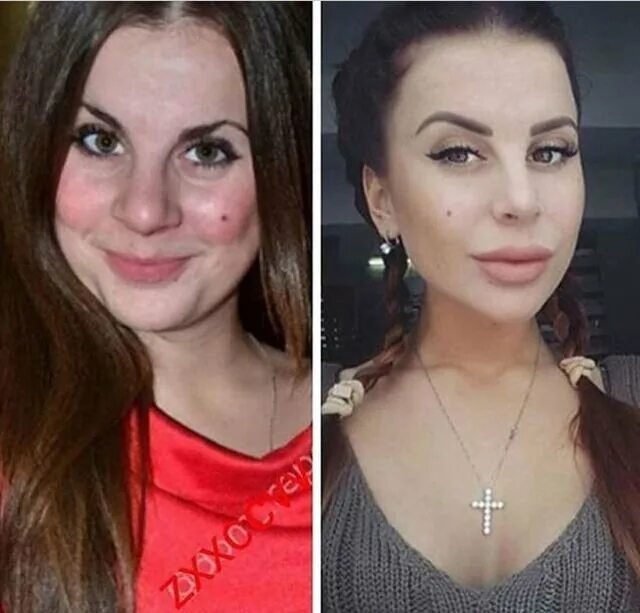 Мирави фото до пластики Участники шоу "ДОМ-2" до и после пластики!!! По секрету, всему свету... Дзен