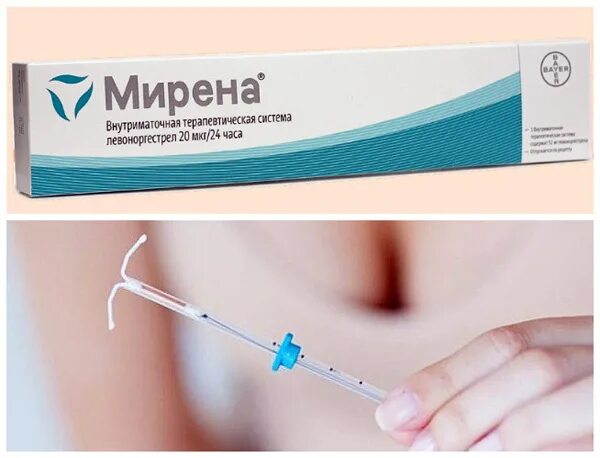 Мирена фото спирали турция фото Эндометриоз - диагностика и лечение. Мирена при эндометриозе - Мирена спираль