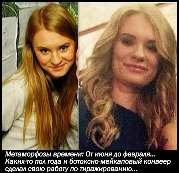 Мирослава регинская фото до пластики и после #регинская #стрелков #гиркин #женсовет #од_новороссия #К25 #орнд #мирославарегин