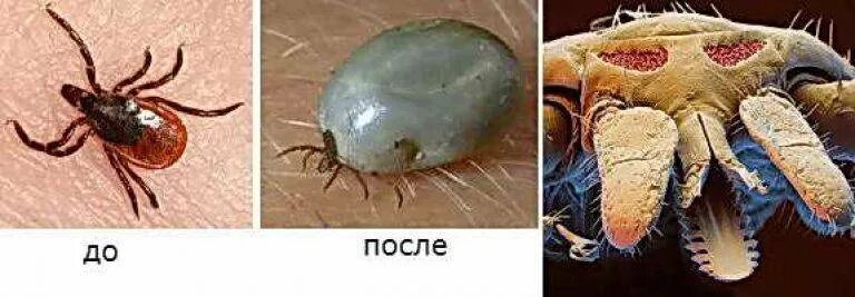 Много клещей на человеке фото Kbt клещи фото - DelaDom.ru
