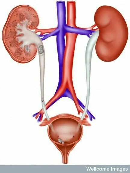 Мочевыделительная система фото Pin de Heidi em Health-Kidney problems Sistema urinario, Sistemas, Radiologia