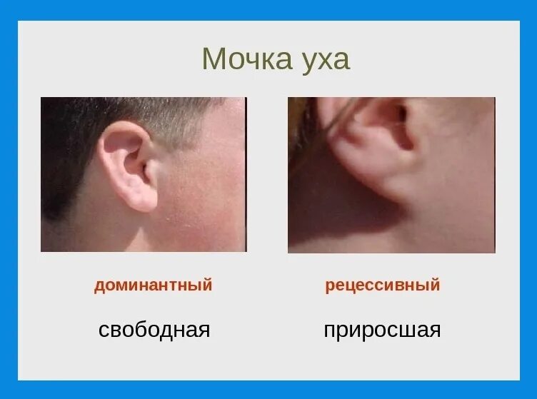 Мочка уха где находится фото Мочки ушей: Мочки ушей могут быть сросшиеся или свободные, и это классический пр