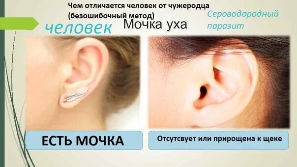 Мочка уха где находится фото Что нужно знать о таком принаке, как приросшая мочка уха - это рецессивный призн