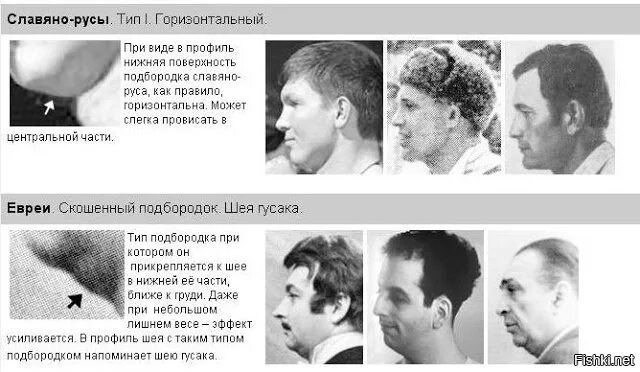 Мочки ушей еврейские фото Хирург поправил ей форму челюсти: просто невероятное преображение