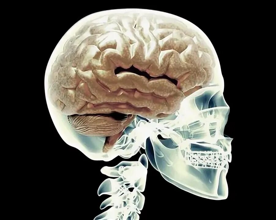 Мозг в черепе фото Brain Scan Mri Images - Browse 14,473 Stock Photos, Vectors, and Video Adobe Sto