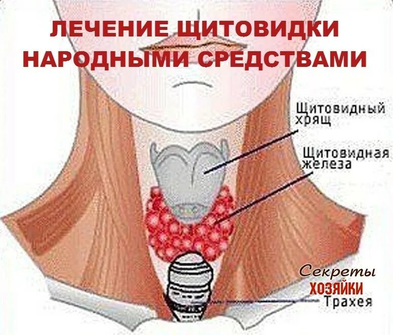 Народные средства симптомы фото Узел щитовидная железе народные средства - найдено 82 картинок
