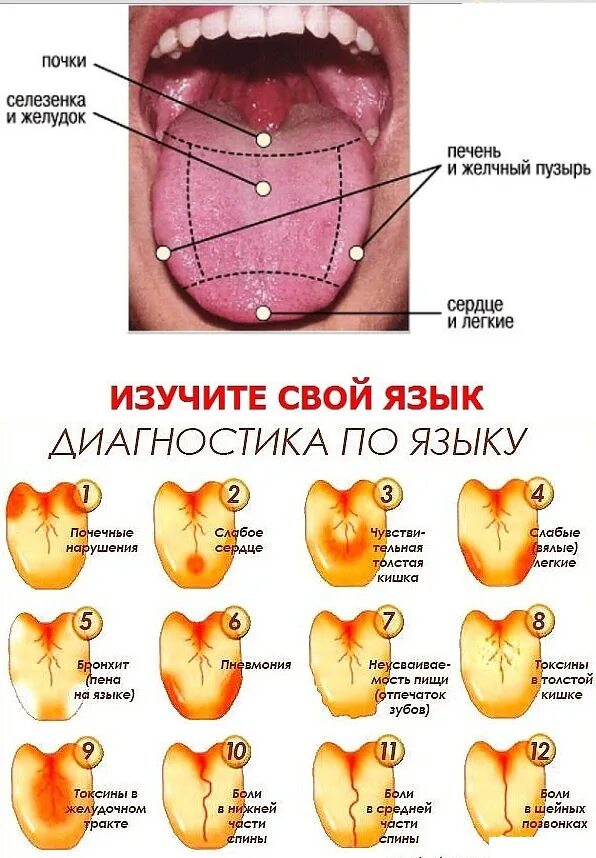 Наросты на языке у горла фото За языком что то есть: найдено 28 изображений