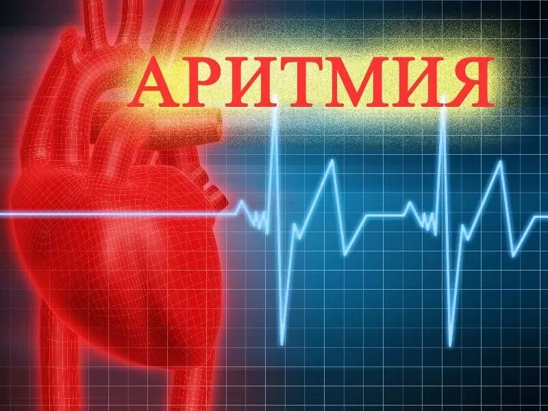 Нарушение ритма сердца фото Бесплатный вопрос-ответ: Аритмия, в чем причина? - смотреть видео онлайн от "Nat