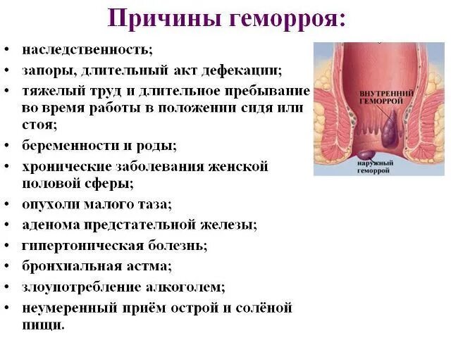 Наружный геморрой как выглядит в реальности причины внутреннего геморроя Лечение, Здоровье, Советы