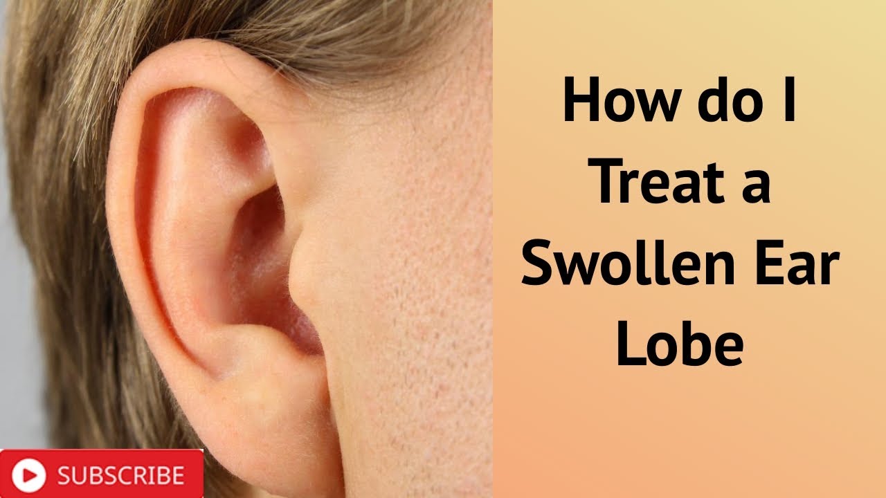 Насекомое в ухе фото How do I Treat a Swollen Ear Lobe - YouTube