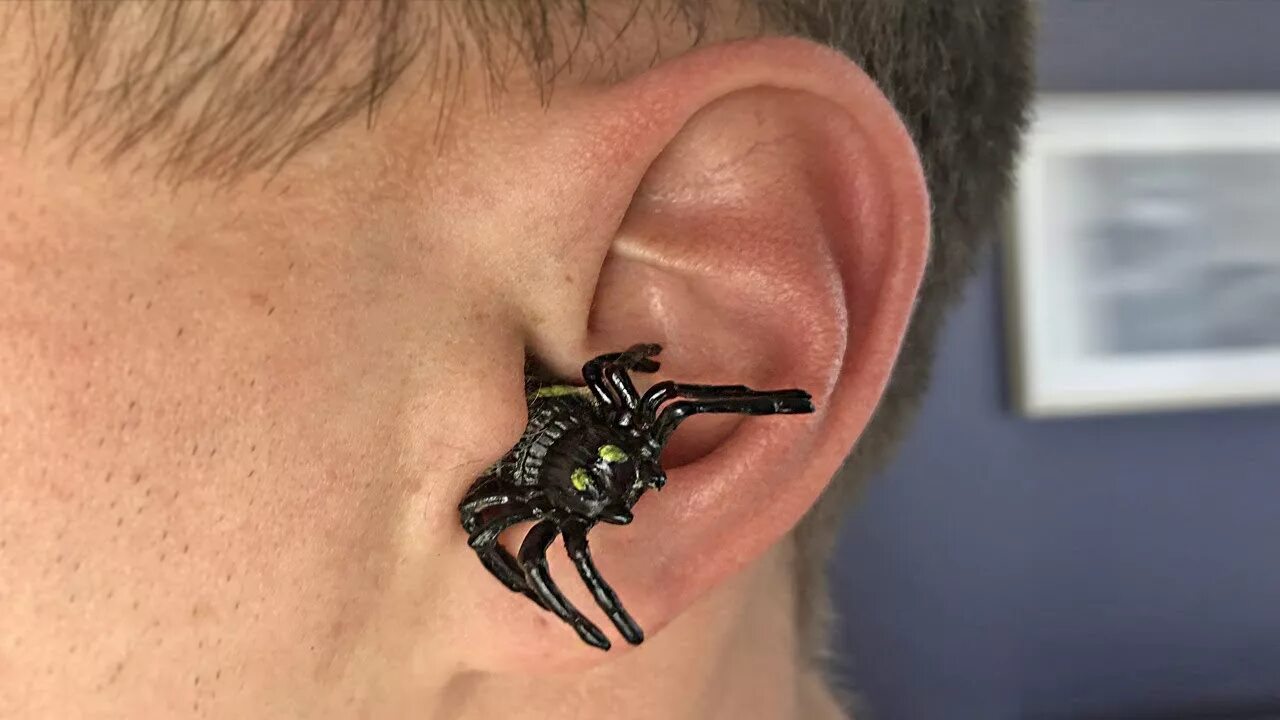 Насекомое в ухе фото Паук в ухе ! SPIDER IN EAR! - YouTube