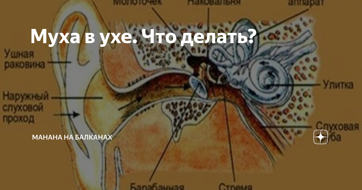 Насекомое в ухе фото Вата от ватной палочки застряла в ухе