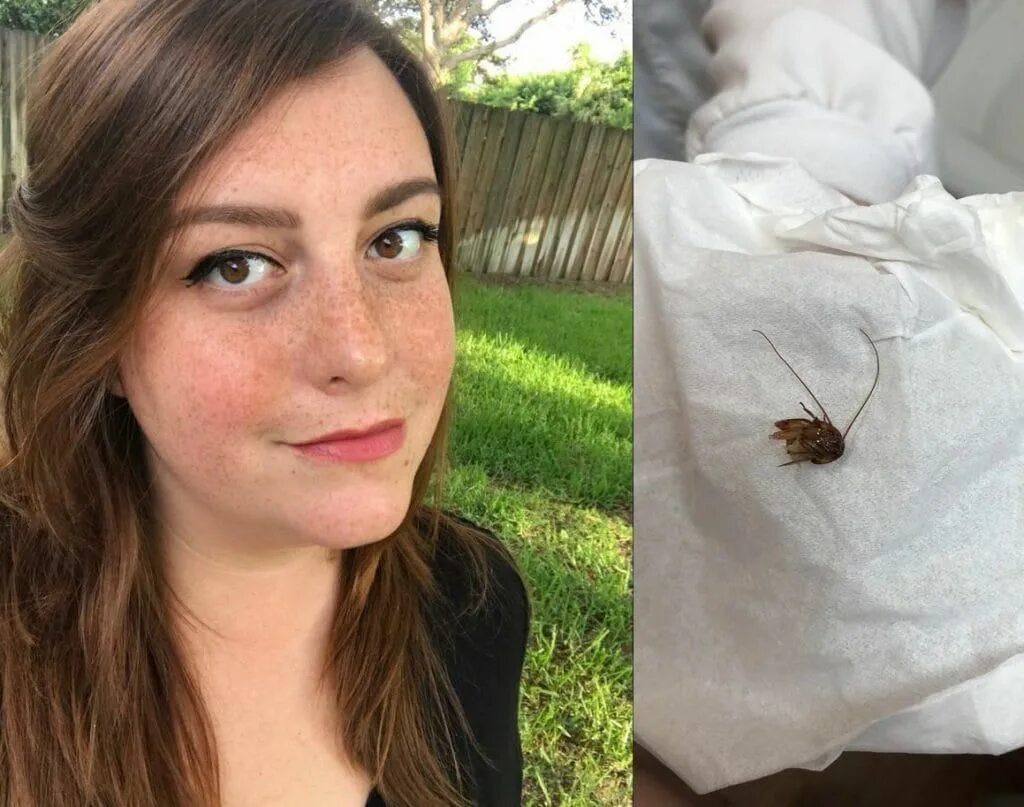 Насекомое в ухе фото Cockroach removed from woman’s ear canal after nine days: 'It was a roach. In my