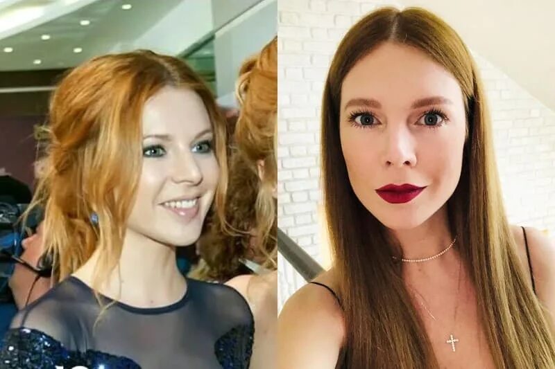 Наталья подольская фото до и после пластики Подольская до пластики до и после фото - ViktoriaFoto.ru