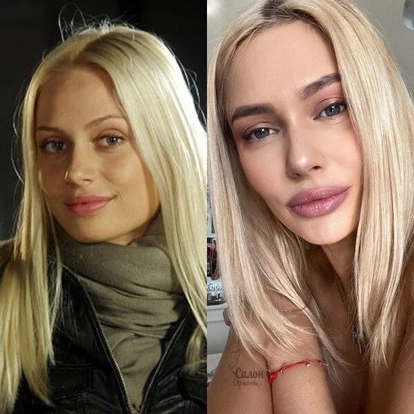 Наталья рудова фото без макияжа Наталья Рудова до пластики, и сейчас. Совершенно два разных человека! 2023 Кином