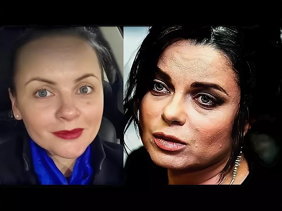 Наташа королева пластика фото Наташу Королеву ОПОЗОРИЛА ее... (31) - YouTube