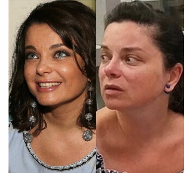 Наташа королева пластика фото до и после Звёзды России ! 40+ без макияжа: шок или восторг? Svetlana V Дзен