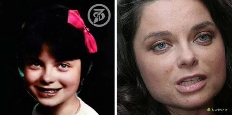 Наташа королева пластика фото до и после Королева без макияжа фото: найдено 87 изображений