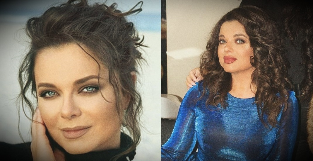 Наташа королева сделала пластику лица фото "Тут нужна губозакатывательная машинка". Знаменитости с пластикой губ. Фото До и