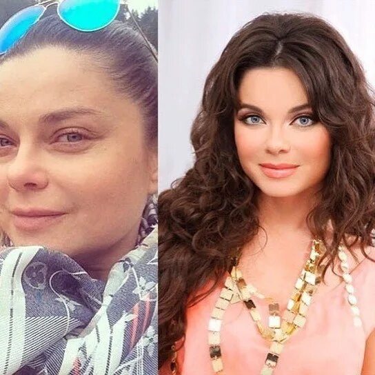 Наташа королева сделала пластику лица фото Передача наташи королевы - найдено 89 картинок