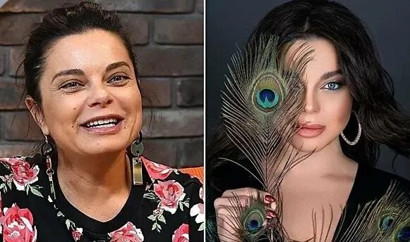 Наташа королева сделала пластику лица фото Собчак показала, как выглядит Наташа Королева в обычной жизни Популярность Пульс