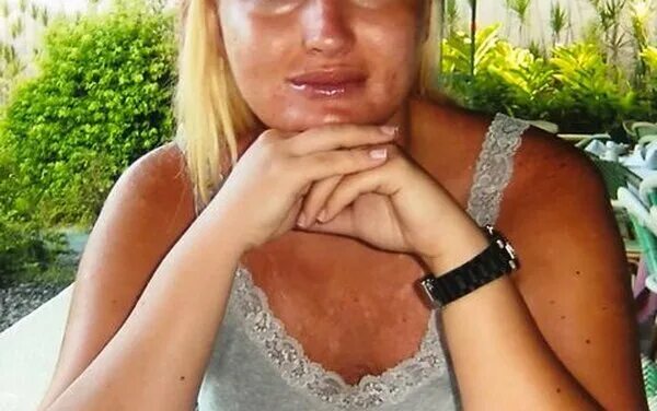 Наташа максимов фото Наташа Максимова призналась, что весила больше 100 килограммов и показала фото д